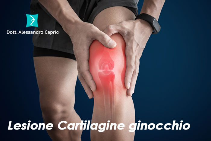 lesione cartilagine ginocchio sintomi