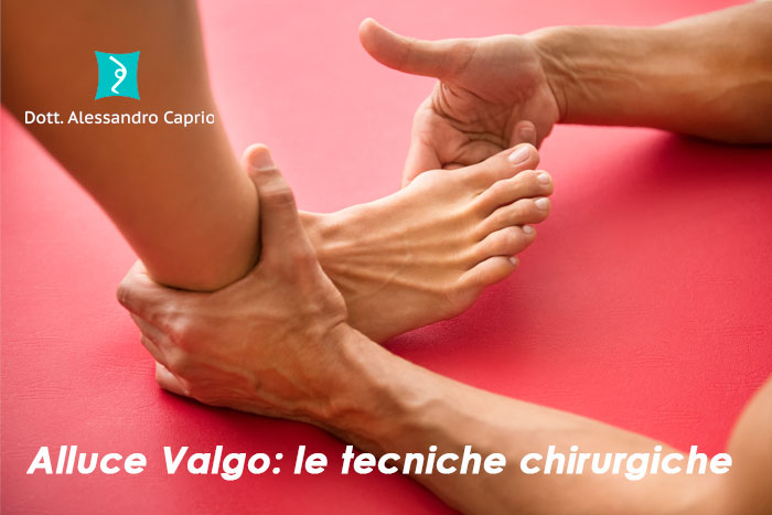 intervento alluce valgo